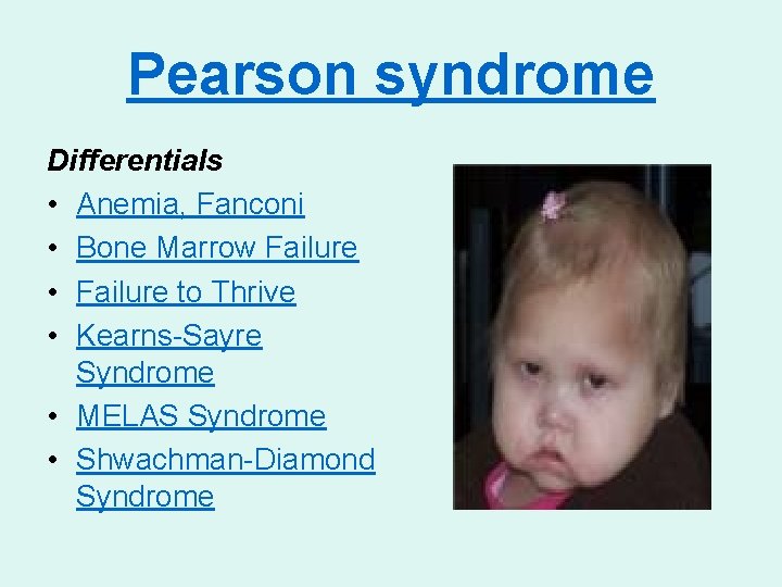 Pearson syndrome Differentials • Anemia, Fanconi • Bone Marrow Failure • Failure to Thrive