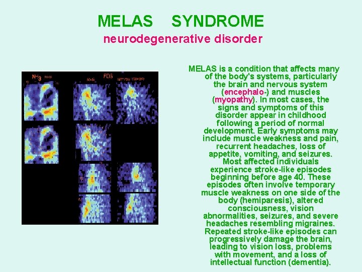 MELAS SYNDROME neurodegenerative disorder MELAS is a condition that affects many of the body's