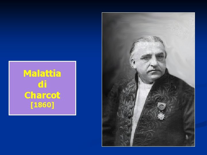 Malattia di Charcot [1860] 