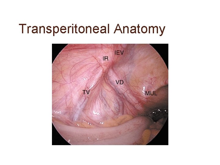 Transperitoneal Anatomy 