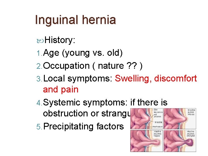 Inguinal hernia History: 1. Age (young vs. old) 2. Occupation ( nature ? ?