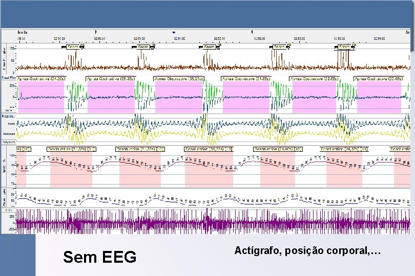 Sem EEG Actígrafo, posição corporal, … 