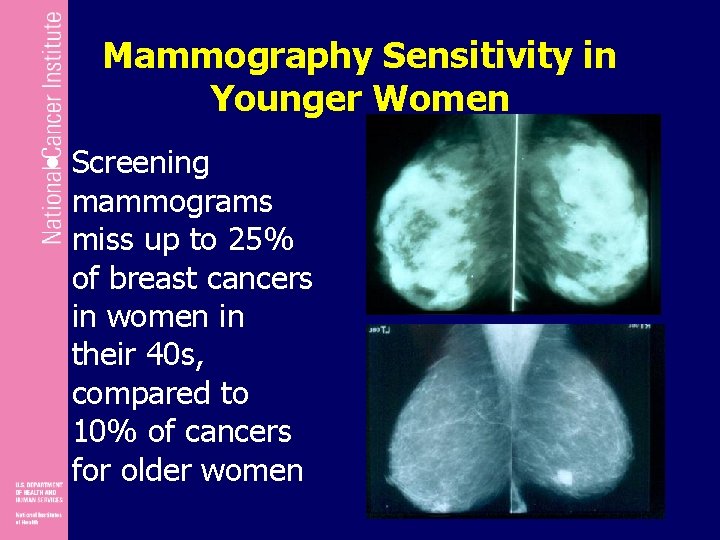 Mammography Sensitivity in Younger Women • Screening mammograms miss up to 25% of breast