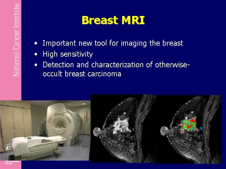 Breast MRI • Important new tool for imaging the breast • High sensitivity •