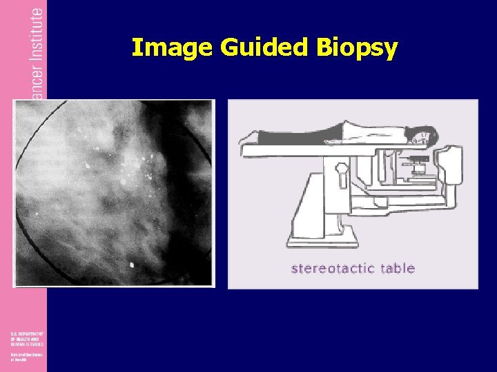 Image Guided Biopsy 