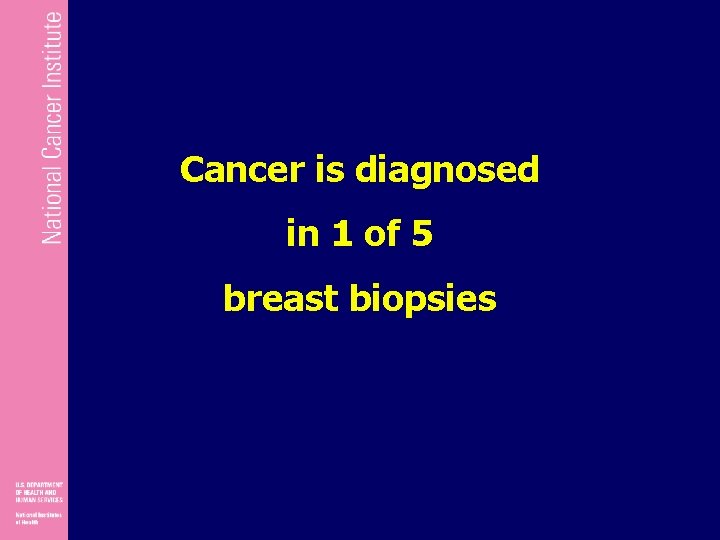 Cancer is diagnosed in 1 of 5 breast biopsies 