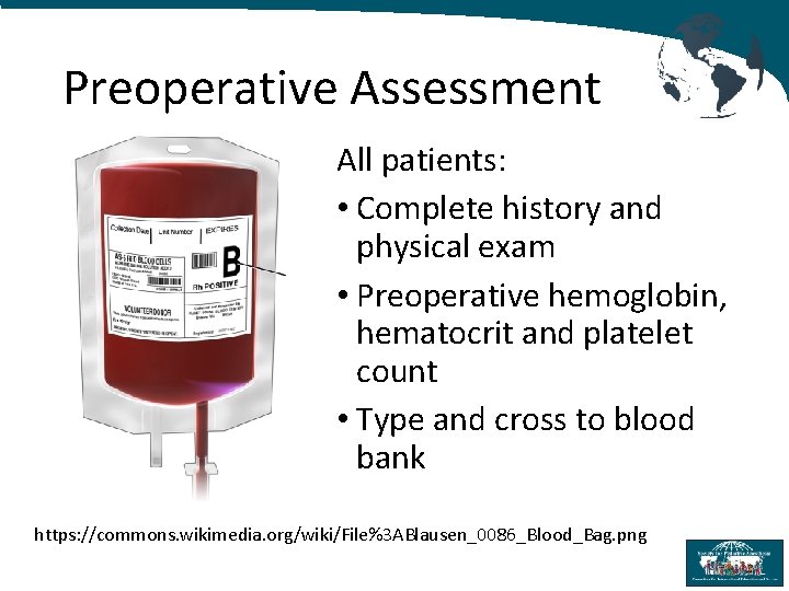 Preoperative Assessment All patients: • Complete history and physical exam • Preoperative hemoglobin, hematocrit