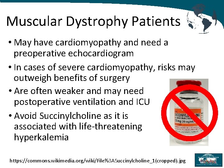 Muscular Dystrophy Patients • May have cardiomyopathy and need a preoperative echocardiogram • In