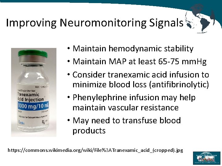Improving Neuromonitoring Signals • Maintain hemodynamic stability • Maintain MAP at least 65 -75