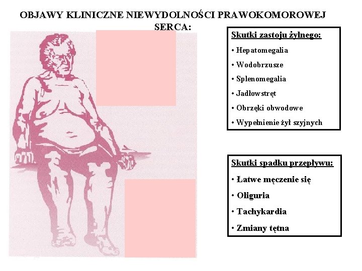 OBJAWY KLINICZNE NIEWYDOLNOŚCI PRAWOKOMOROWEJ SERCA: Skutki zastoju żylnego: • Hepatomegalia • Wodobrzusze • Splenomegalia