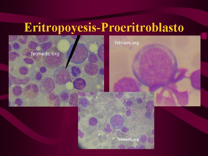 Eritropoyesis-Proeritroblasto 