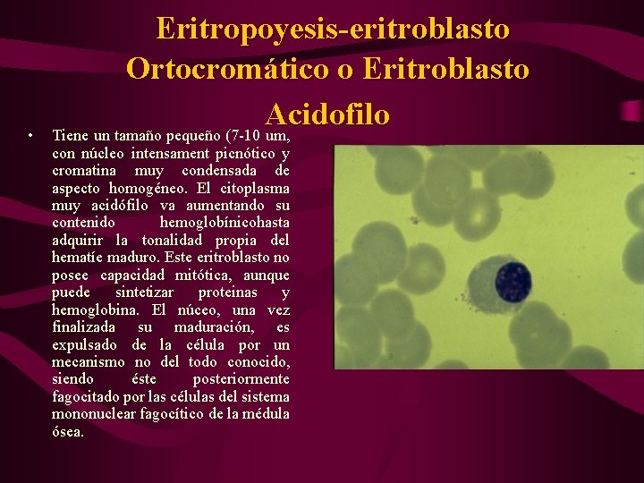  • Eritropoyesis-eritroblasto Ortocromático o Eritroblasto Acidofilo Tiene un tamaño pequeño (7 -10 um,