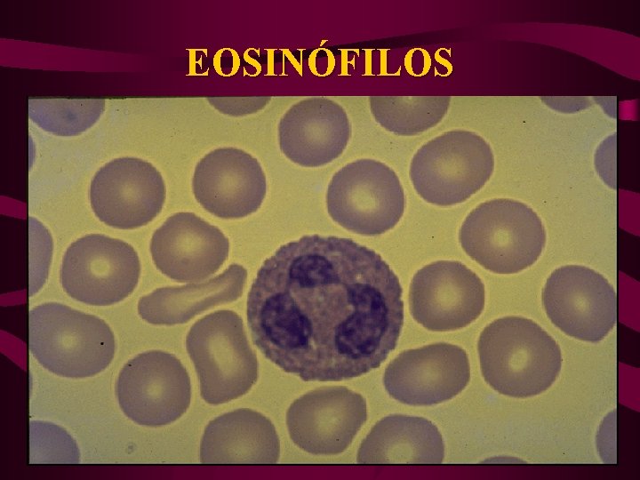 EOSINÓFILOS 
