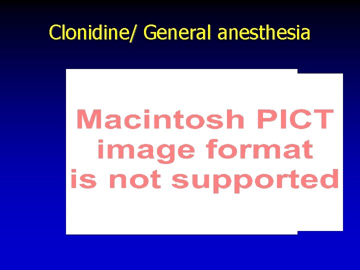 Clonidine/ General anesthesia 