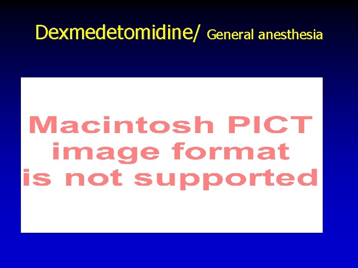 Dexmedetomidine/ General anesthesia 