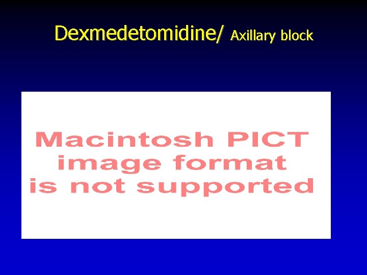 Dexmedetomidine/ Axillary block 