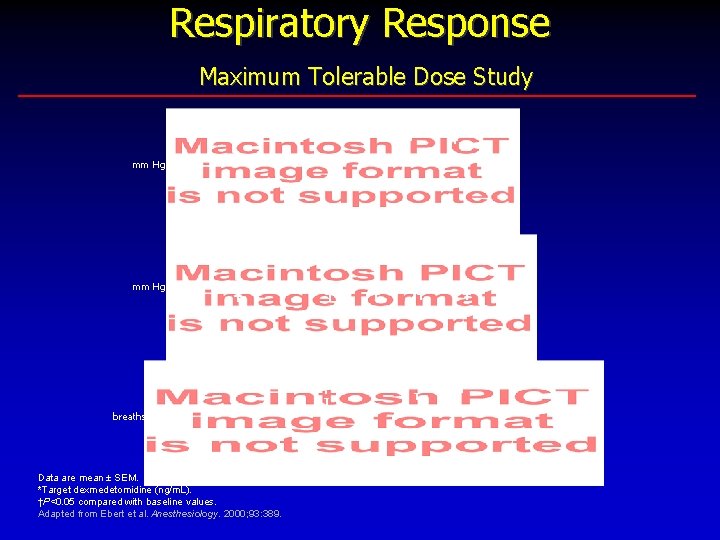 Respiratory Response Maximum Tolerable Dose Study Pa. O 2 mm Hg Pa. CO 2