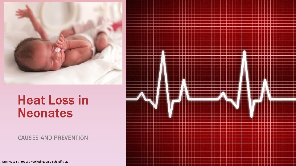 Heat Loss in Neonates CAUSES AND PREVENTION Ann Waters: Product Marketing: QED Scientific Ltd.