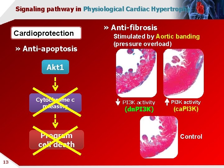 Signaling pathway in Physiological Cardiac Hypertrophy Cardioprotection » Anti-apoptosis » Anti-fibrosis Stimulated by Aortic