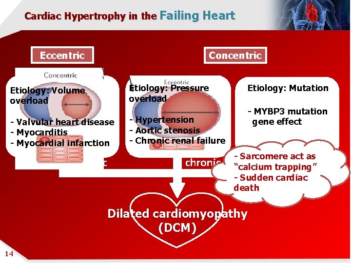 Cardiac Hypertrophy in the Failing Heart Eccentric Concentric Etiology: Volume overload Etiology: Pressure overload