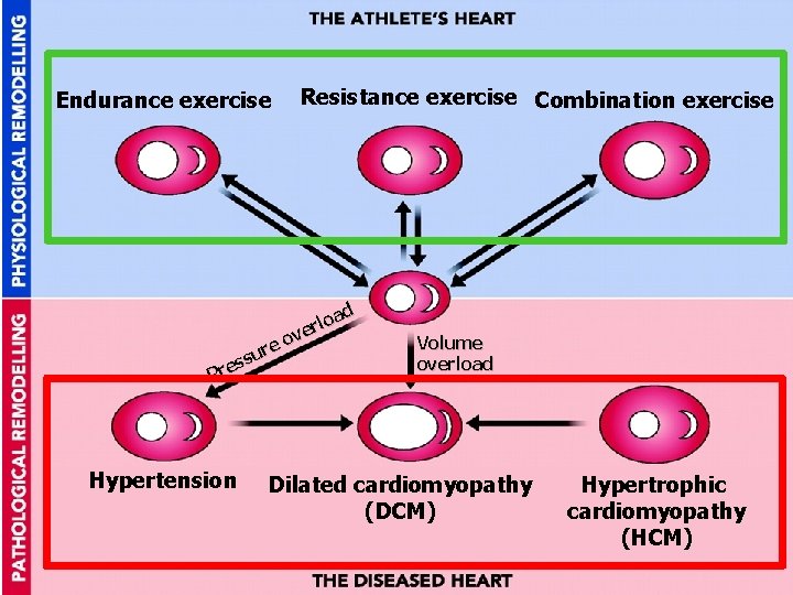 Endurance exercise ure s s Pre Hypertension 23 22 Resistance exercise Combination exercise d