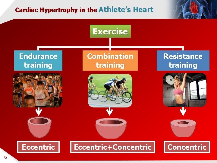 Cardiac Hypertrophy in the Athlete’s Heart Exercise Endurance training Eccentric 6 6 Combination training