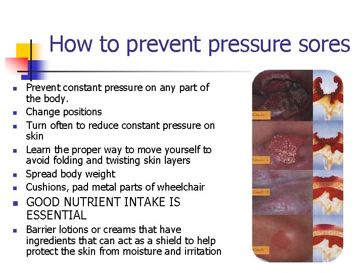 How to prevent pressure sores n n n n Prevent constant pressure on any