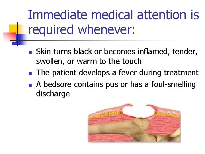 Immediate medical attention is required whenever: n n n Skin turns black or becomes