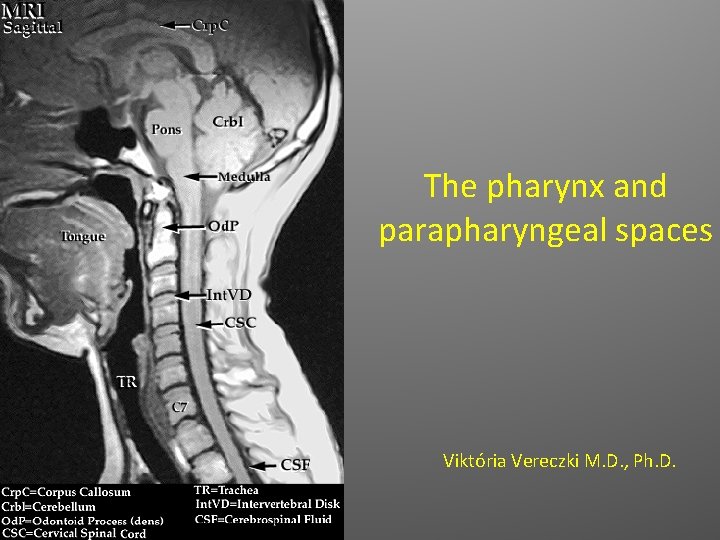 The pharynx and parapharyngeal spaces Viktória Vereczki M. D. , Ph. D. 