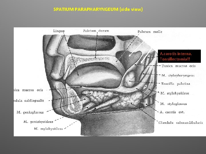 SPATIUM PARAPHARYNGEUM (side view) Epipharynx Spatium parapharyngeum A. carotis interna. Tonsillectomia!! 