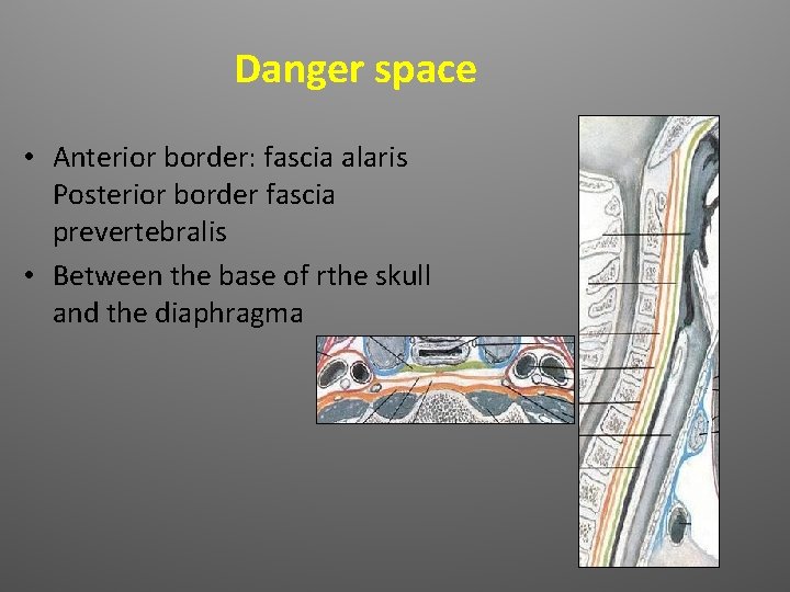 Danger space • Anterior border: fascia alaris Posterior border fascia prevertebralis • Between the