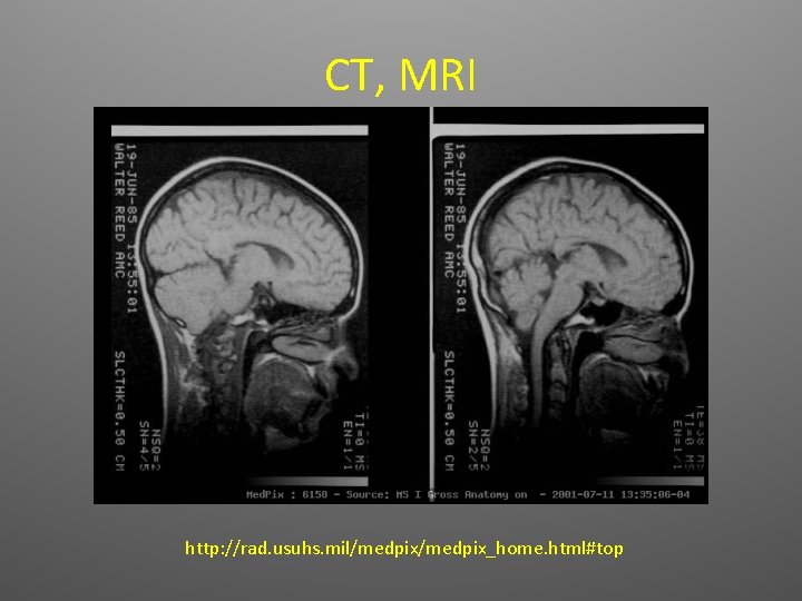 CT, MRI http: //rad. usuhs. mil/medpix_home. html#top 