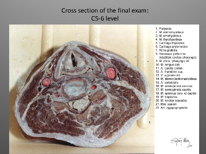 Cross section of the final exam: C 5 -6 level 