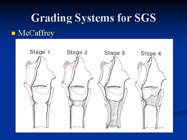Grading Systems for SGS n Mc. Caffrey 