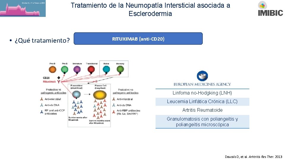 Tratamiento de la Neumopatía Intersticial asociada a Esclerodermia • ¿Qué tratamiento? RITUXIMAB (anti-CD 20)