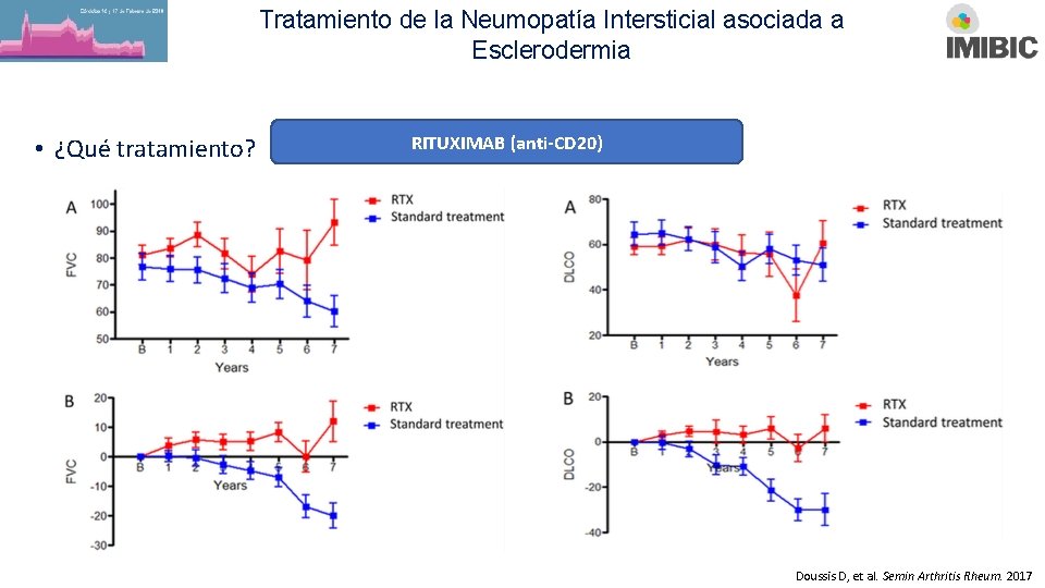 Tratamiento de la Neumopatía Intersticial asociada a Esclerodermia • ¿Qué tratamiento? RITUXIMAB (anti-CD 20)