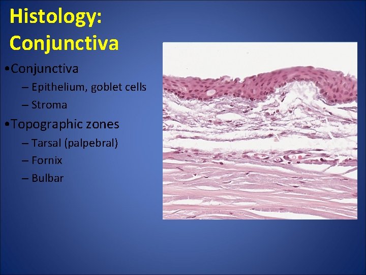 Histology: Conjunctiva • Conjunctiva ‒ Epithelium, goblet cells ‒ Stroma • Topographic zones ‒ Histology: Conjunctiva • Conjunctiva ‒ Epithelium, goblet cells ‒ Stroma • Topographic zones ‒