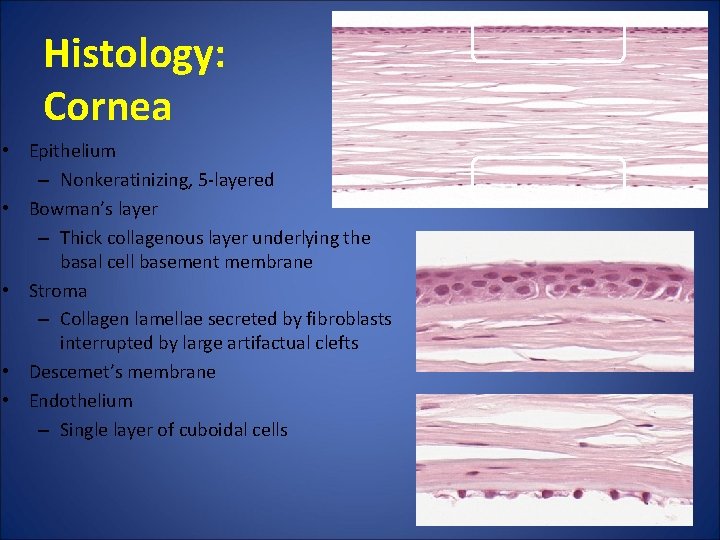 Histology: Cornea • Epithelium – Nonkeratinizing, 5 -layered • Bowman’s layer – Thick collagenous Histology: Cornea • Epithelium – Nonkeratinizing, 5 -layered • Bowman’s layer – Thick collagenous