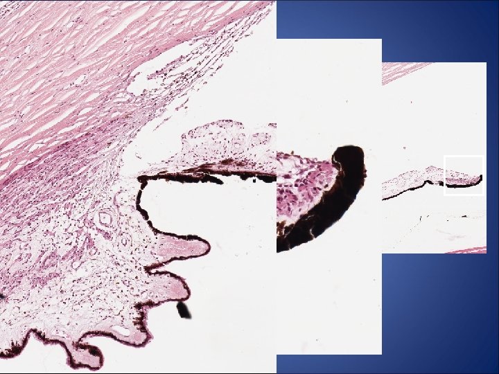 Histology : Iris/ ciliary body • Iris – Anterior limiting layer’-Stroma • Sphincter pupillae Histology : Iris/ ciliary body • Iris – Anterior limiting layer’-Stroma • Sphincter pupillae