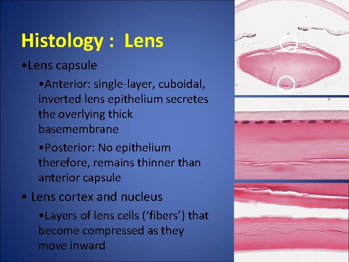 Histology : Lens • Lens capsule • Anterior: single-layer, cuboidal, inverted lens epithelium secretes Histology : Lens • Lens capsule • Anterior: single-layer, cuboidal, inverted lens epithelium secretes