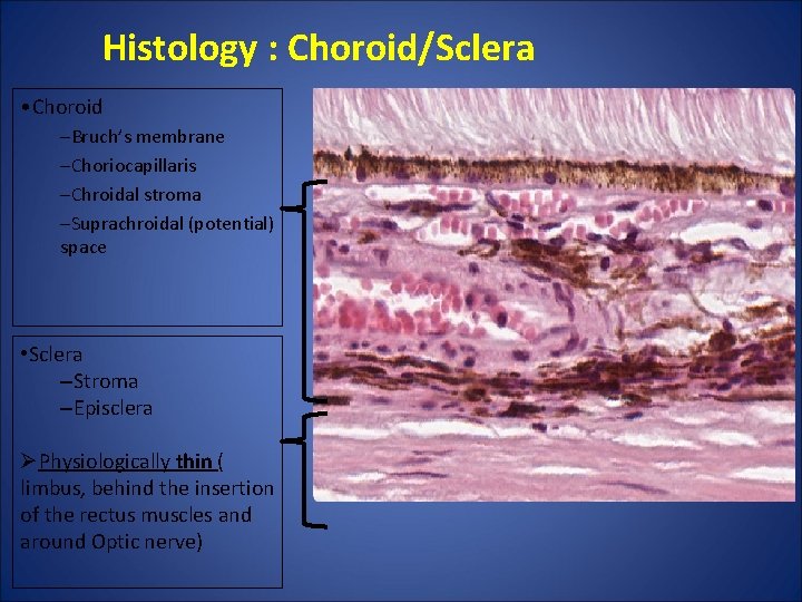 Histology : Choroid/Sclera • Choroid –Bruch’s membrane –Choriocapillaris –Chroidal stroma –Suprachroidal (potential) space • Histology : Choroid/Sclera • Choroid –Bruch’s membrane –Choriocapillaris –Chroidal stroma –Suprachroidal (potential) space •