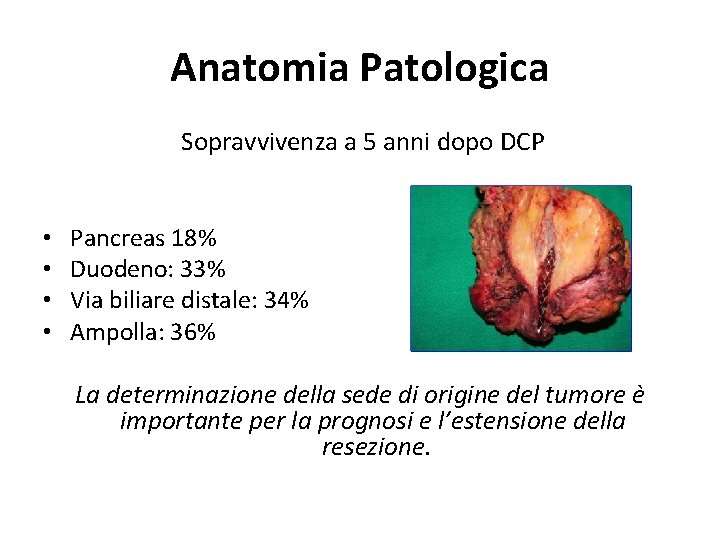 Anatomia Patologica Sopravvivenza a 5 anni dopo DCP • • Pancreas 18% Duodeno: 33% Anatomia Patologica Sopravvivenza a 5 anni dopo DCP • • Pancreas 18% Duodeno: 33%