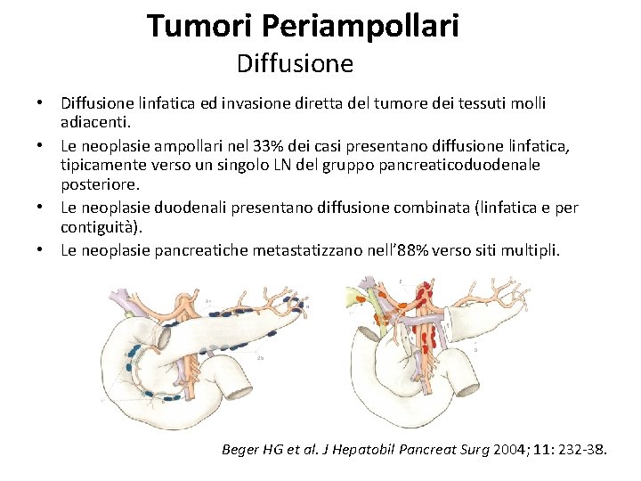 Tumori Periampollari Diffusione • Diffusione linfatica ed invasione diretta del tumore dei tessuti molli Tumori Periampollari Diffusione • Diffusione linfatica ed invasione diretta del tumore dei tessuti molli