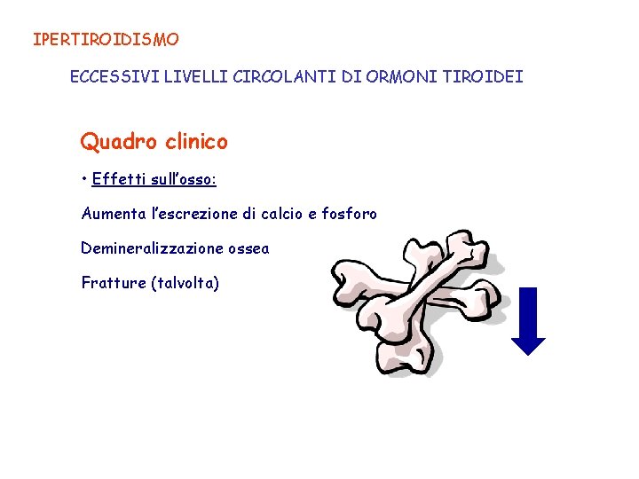 IPERTIROIDISMO ECCESSIVI LIVELLI CIRCOLANTI DI ORMONI TIROIDEI Quadro clinico • Effetti sull’osso: Aumenta l’escrezione