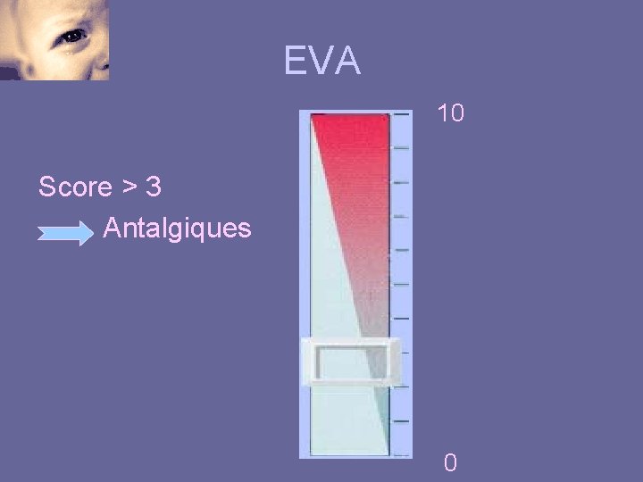 EVA 10 Score > 3 Antalgiques 0 