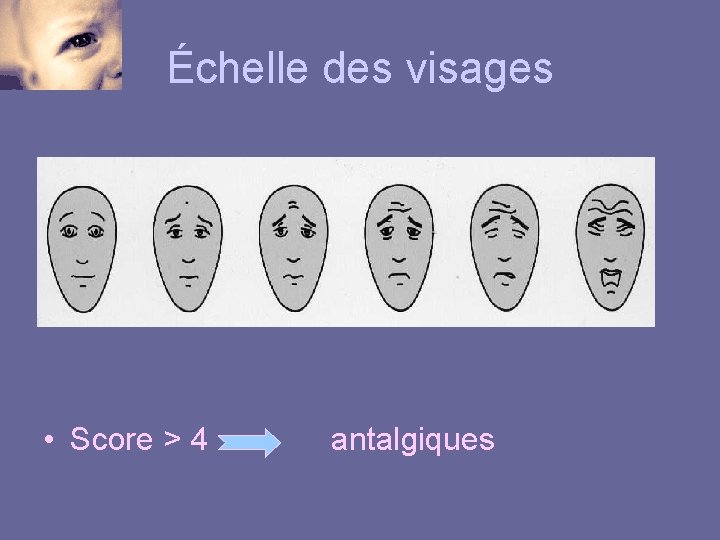 Échelle des visages • Score > 4 antalgiques 