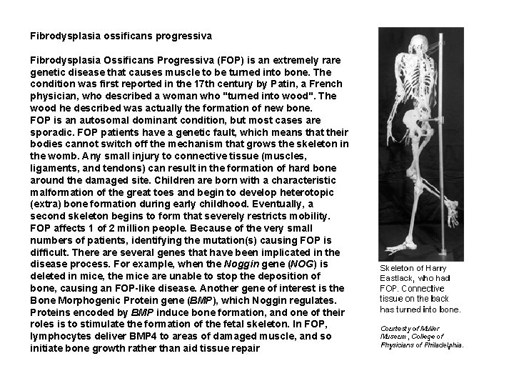 Fibrodysplasia ossificans progressiva Fibrodysplasia Ossificans Progressiva (FOP) is an extremely rare genetic disease that