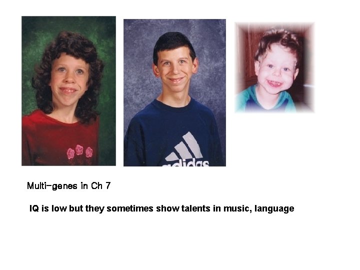 Multi-genes in Ch 7 IQ is low but they sometimes show talents in music,