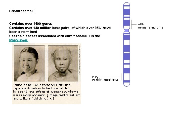 Chromosome 8 Contains over 1400 genes Contains over 140 million base pairs, of which