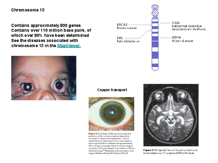 Chromosome 13 Contains approximately 800 genes Contains over 110 million base pairs, of which